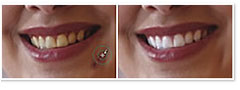 Makeover Tools