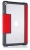 STM